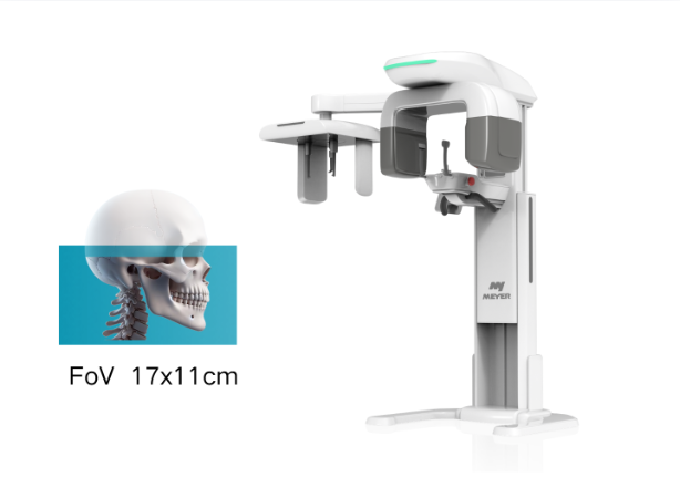 MEYER CONE BEAM COMPUTED TOMOGRAPHY FOV 12x10